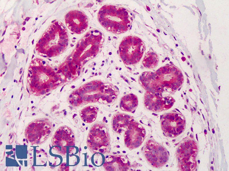 IHC-plus™ Polyclonal Rabbit anti-Human IRS1 Antibody (IHC, IF, WB)