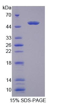 Mouse TRDN / Triadin Protein (Recombinant)