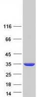 Human SULT1A2 / Sulfotransferase 1A2 Protein (Recombinant Myc-DDK (Flag))