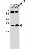 TCL / RHOJ Antibody (aa131-159)
