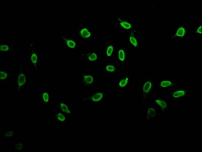 Polyclonal Rabbit anti-Human HIST1H3A Antibody (IHC, IF, WB)