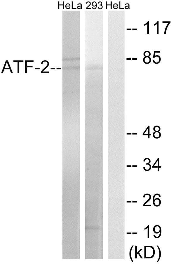 ATF2 Antibody (p472)