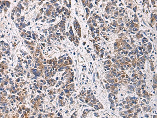 HSDL2 Antibody