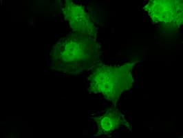 IHC-plus™ Monoclonal Mouse anti-Human TKT / Transketolase Antibody (clone 5H3, IHC, IF, WB)