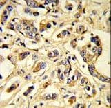 FLT1 / VEGFR1 Antibody