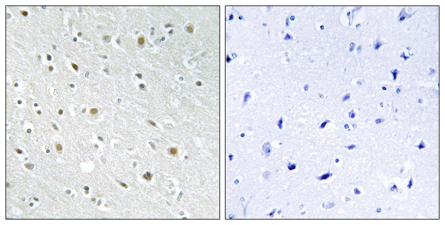 Polyclonal Rabbit anti-Human SSBP2 Antibody (IHC, WB)