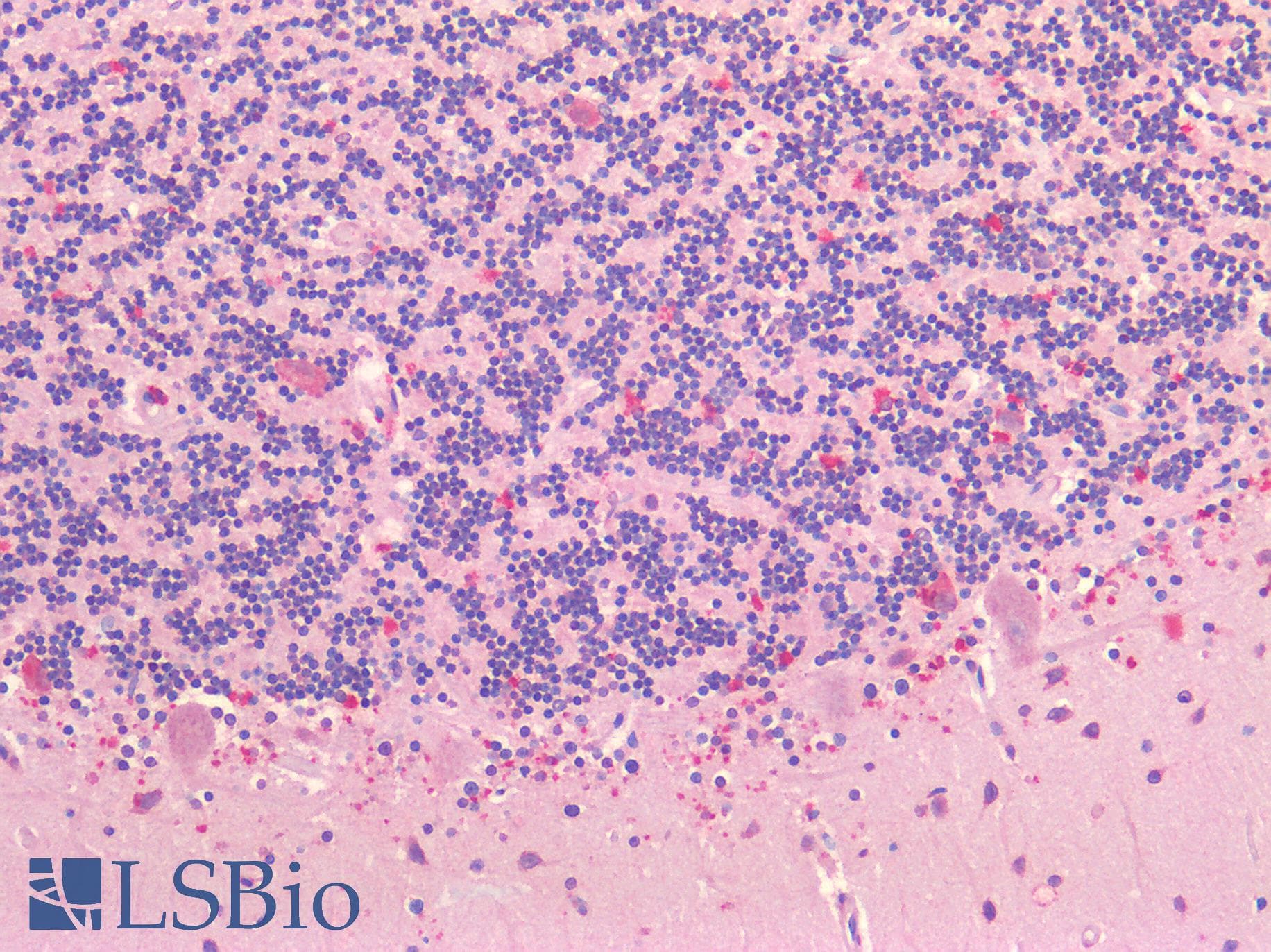 IHC-plus™ NOTCH2 Antibody