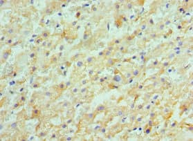Polyclonal Rabbit anti-Human ACVR2 / ACVR2A Antibody (aa20-140, IHC)