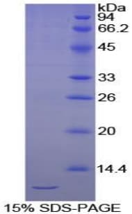 Chicken CDH1 / E Cadherin Protein (Recombinant His)