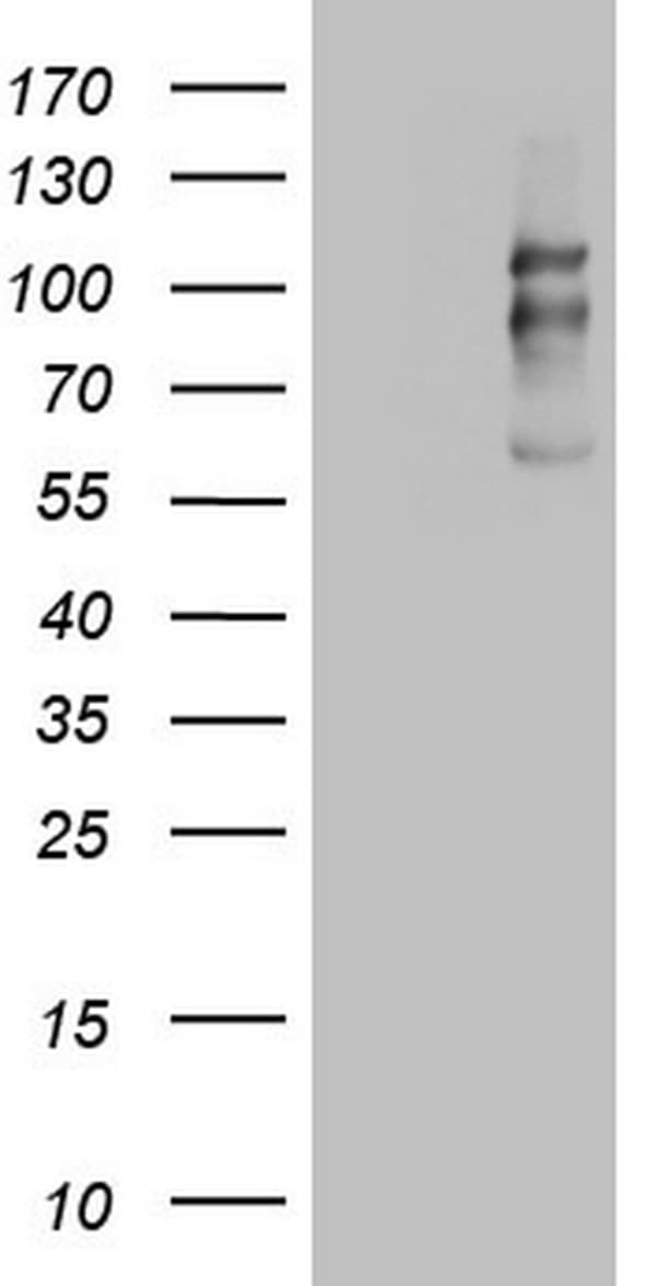 Monoclonal Mouse anti-Human CDH1 / E Cadherin Antibody (clone OTI3C11, Extracellular Domain, WB)