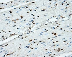 Monoclonal Mouse anti-Human PSMC3 Antibody (clone OTI1C10, IHC, IF, WB)