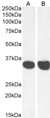 IHC-plus™ MDH / MDH2 Antibody (aa221-232)