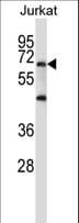 PRDM6 Antibody (aa44-72)