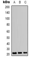 Polyclonal Rabbit anti-Human CD3E Antibody (Internal, WB)