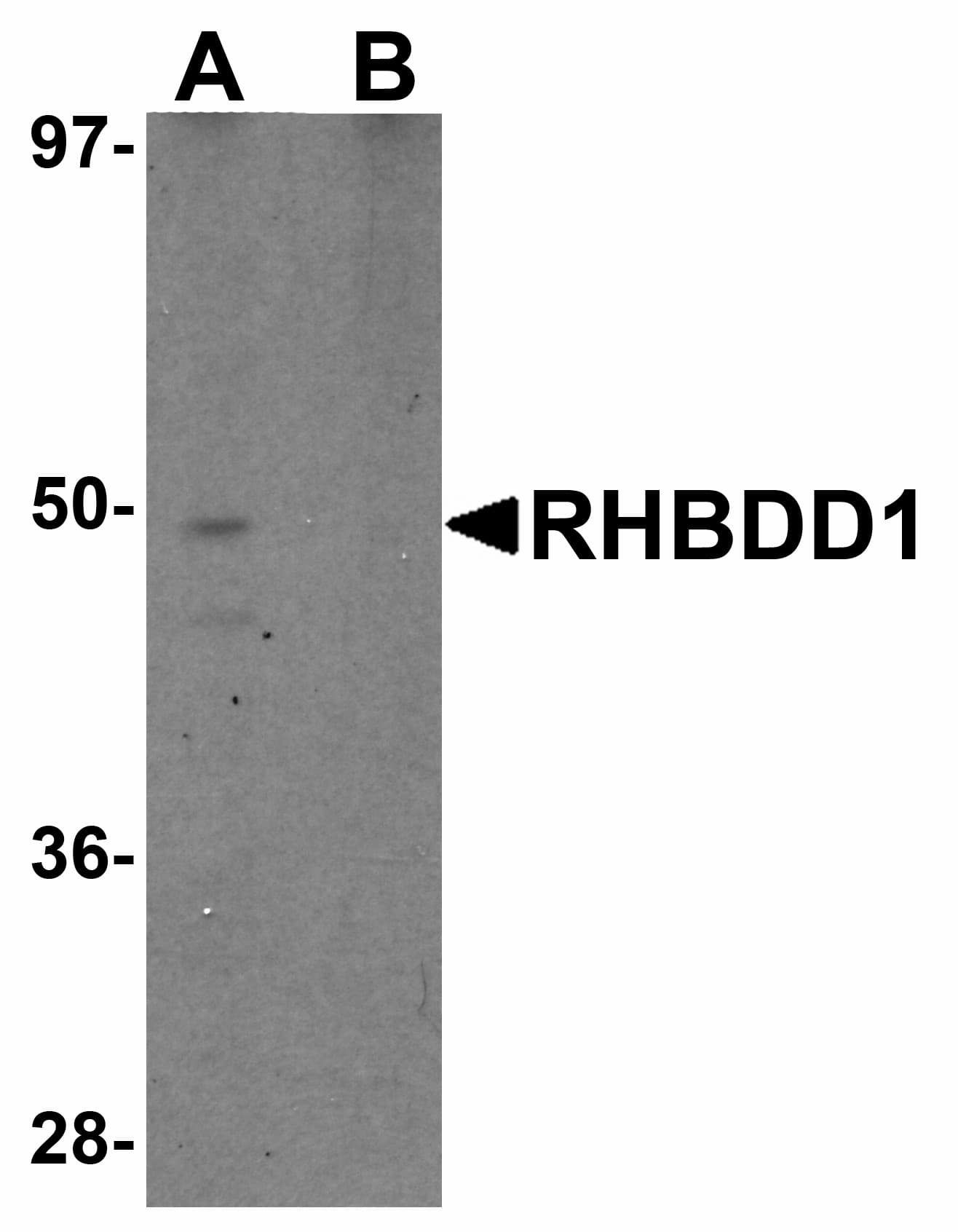 Polyclonal Rabbit anti-Human RHBDD1 Antibody (WB)