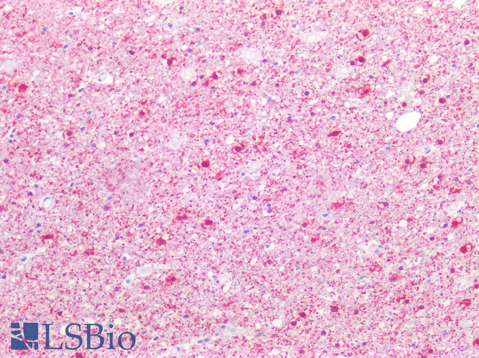 IHC-plus™ Polyclonal Rabbit anti-Human STMN1 / Stathmin / LAG Antibody (IHC, IF, WB)