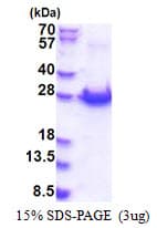 Human PCMTD1 Protein (Recombinant His)