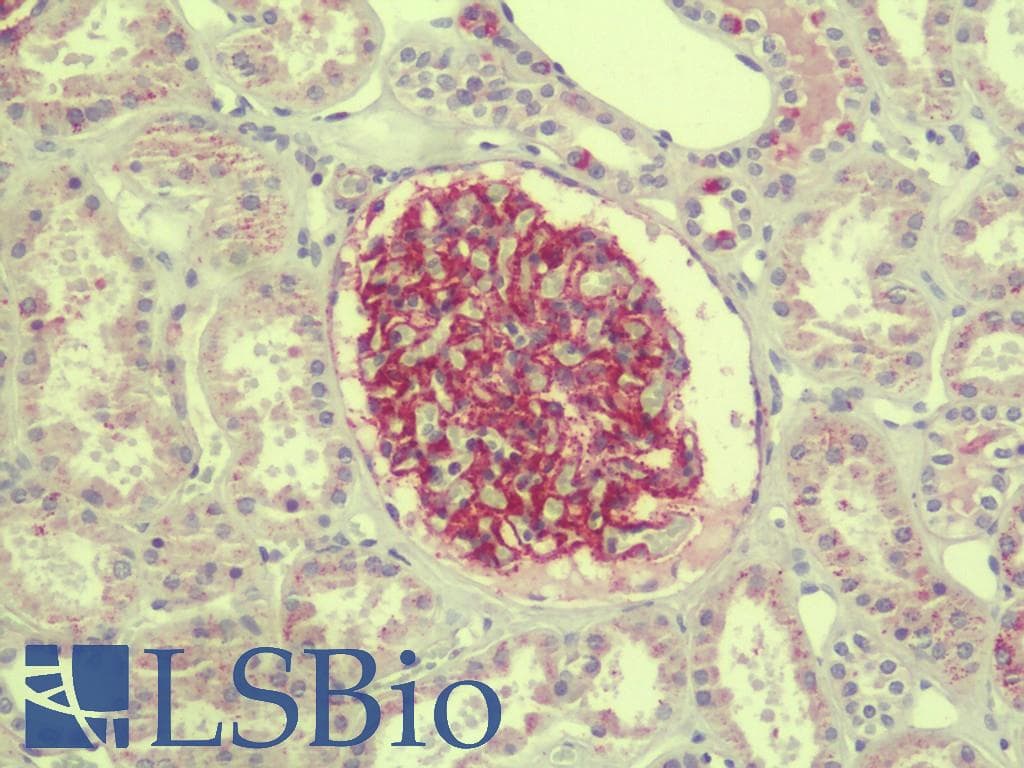 IHC-plus™ Polyclonal Rabbit anti-Human LEMD3 / MAN1 Antibody (IHC, IF, WB)
