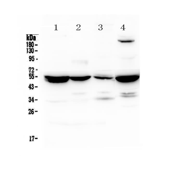 ASL / Argininosuccinate Lyase Antibody