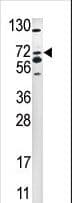 SMURF2 Antibody (aa702-731)