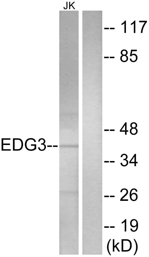 Polyclonal Rabbit anti-Human SIPR3 / EDG3 / S1P3 Antibody (aa1-50, IF, WB)
