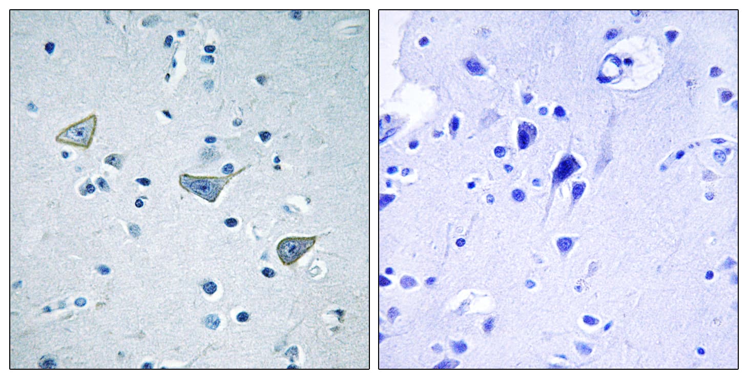 Polyclonal Rabbit anti-Human GPR158 Antibody (aa1-50, IHC, IF, WB)