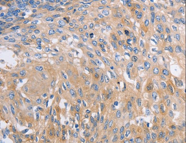 Polyclonal Rabbit anti-Human NBEA / Neurobeachin Antibody (IHC)