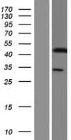 KRT33A / Keratin 33A / KRTHA3A Protein (Over-Expression Lysate Myc-DDK (Flag))