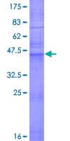 Human CLDN5 / Claudin 5 Protein (Recombinant GST)