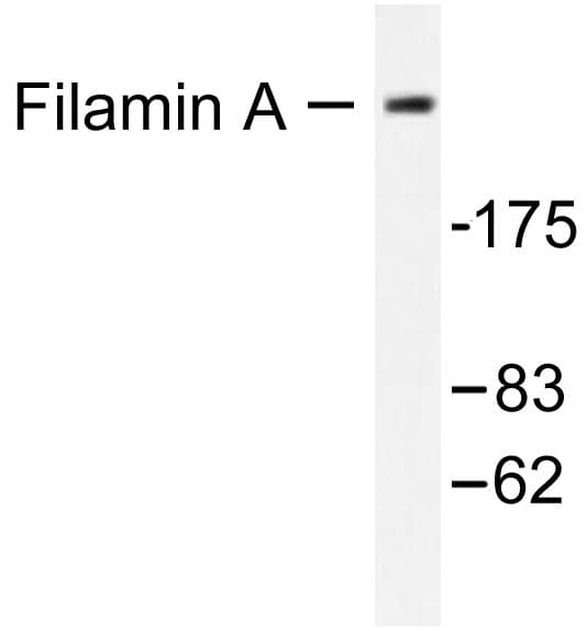 FLNA / Filamin A Antibody (Arg2146)