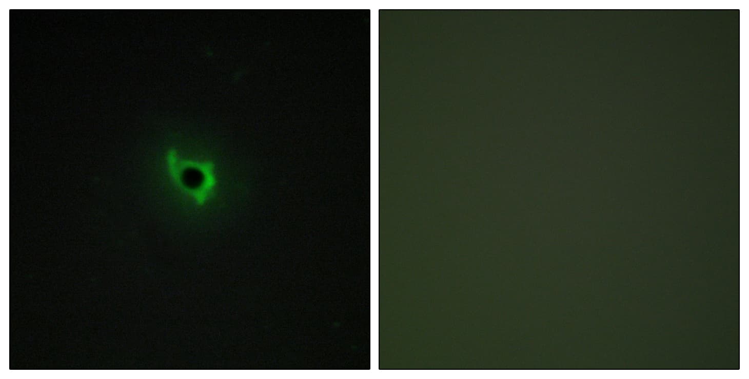IHC-plus™ EPHA6 / EPH Receptor A6 Antibody (aa891-940)