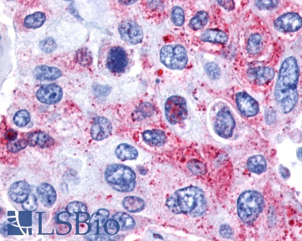 PathPlus™ GPR139 Antibody (Cytoplasmic Domain)