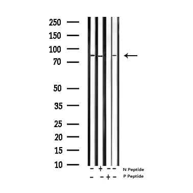 SP1 Antibody (phospho-Thr453)