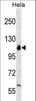 POLR1B Antibody (aa89-117)