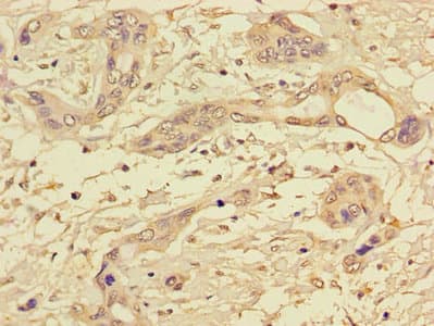 PPP1CC / PP1 Gamma Antibody