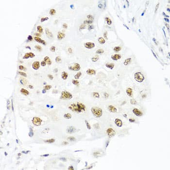 p84 / THOC1 Antibody