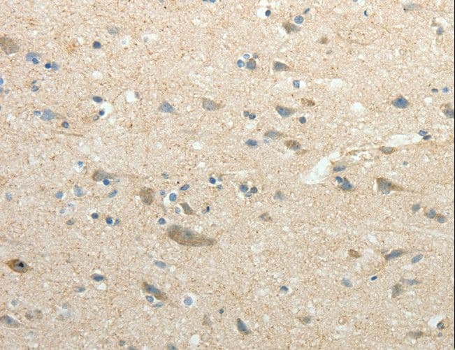 Polyclonal Rabbit anti-Human SIRT3 / Sirtuin 3 Antibody (IHC, WB)