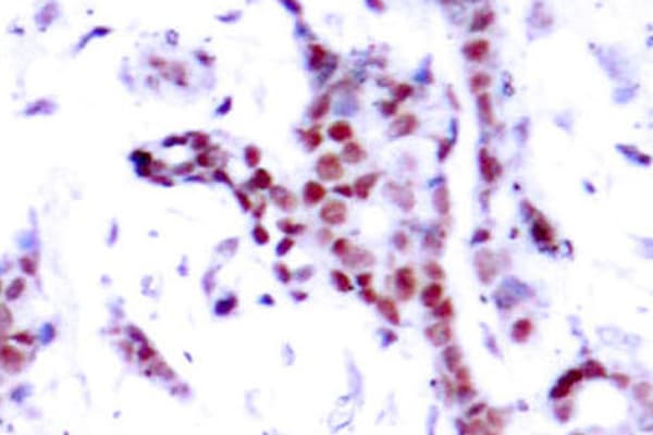 STAT1 Antibody (phospho-Tyr701)