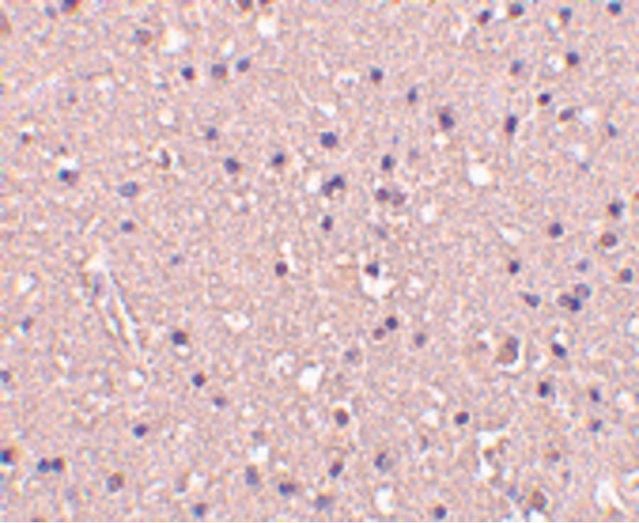 Polyclonal Rabbit anti-Human CRMP1 Antibody (IHC, IF, WB)