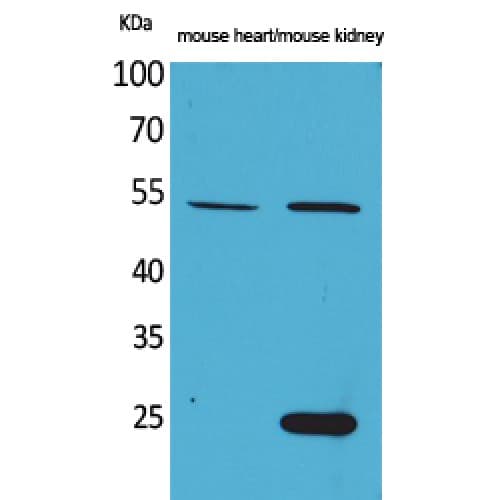 SCG3 / Secretogranin 3 Antibody (11-60 aa, N-terminal)