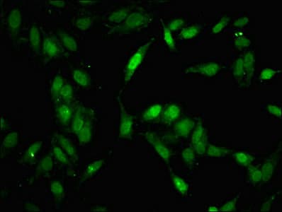 Polyclonal Rabbit anti-Human MAP3K11 / MLK3 Antibody (IHC, IF)