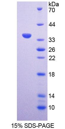 Rat VG5Q / AGGF1 Protein (Recombinant His-T7)