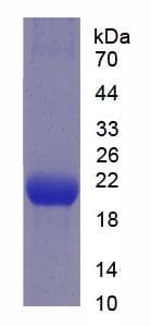 Human PDGF-BB Protein (Recombinant His-S)