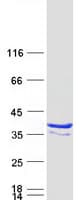 Human RFPL3 Protein (Recombinant Myc-DDK (Flag))