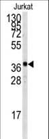 TAL1 Antibody (Thr90)
