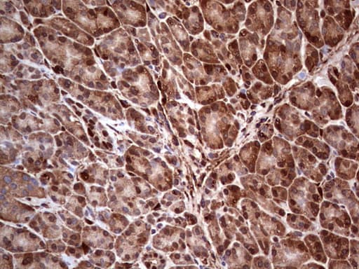 LGALS3 / Galectin 3 Antibody (clone OTI2F1)