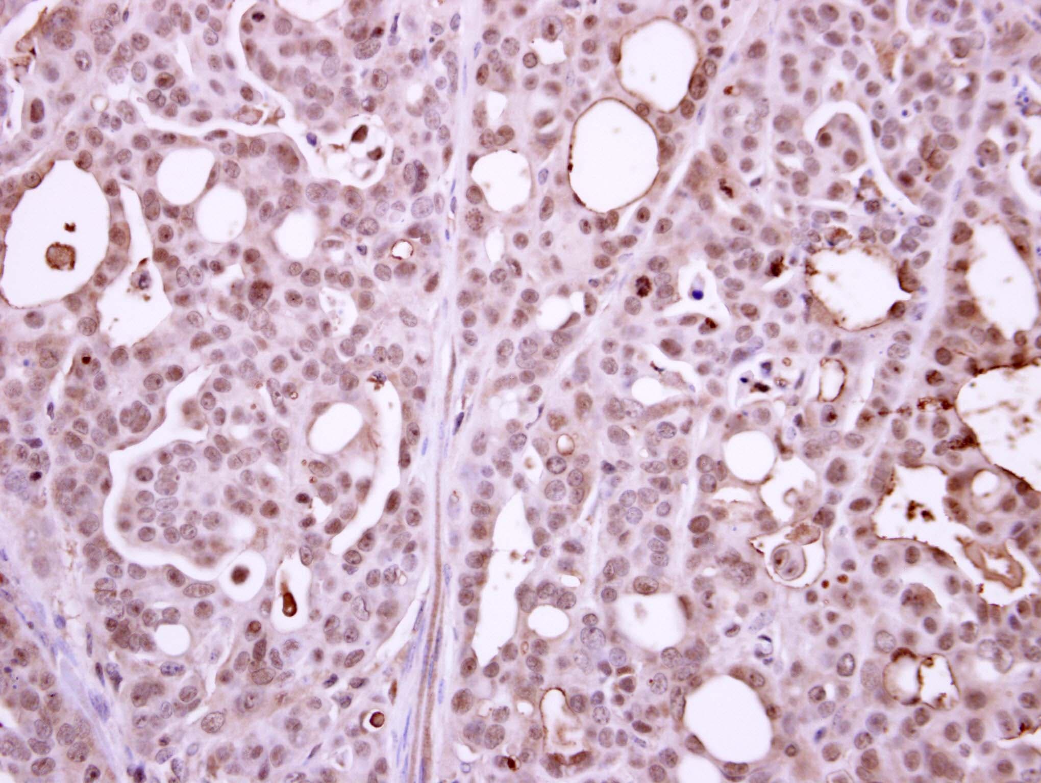 Polyclonal Rabbit anti-Human POLR2B / RPB2 Antibody (aa1-172, IHC, WB)