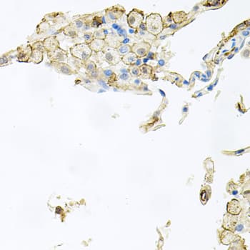 Polyclonal Rabbit anti-Human AIF1 / IBA1 Antibody (IHC, IF, WB)