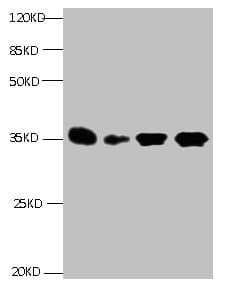 IGFBP1 Antibody (clone 1E1B2)