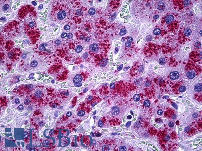 IHC-plus™ CAT / Catalase Antibody (aa361-410)